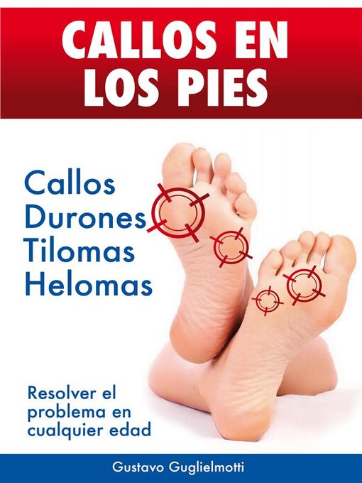 Title details for CALLOS EN LOS PIES--Solución definitiva para Callos, Tilomas y Helomas. by Gustavo Guglielmotti - Available